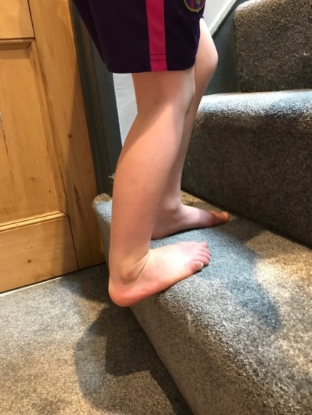 Flat feet sales in teenager
